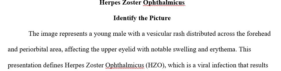 BG is a 24 year male weighing 180 pounds at 5’ 8 was schedule as a regular follow up for the following rash