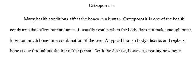 Explain the risk factors for osteoporosis. What can a nurse do to help manage this health condition