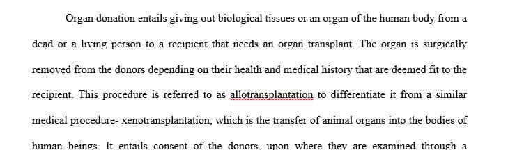 Write a 1,500-1,750-word policy proposal related to the sale, trade or donation of human organs using five to seven academic resources.